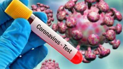 koronavirus-1-1585040422-AZeFT.jpg