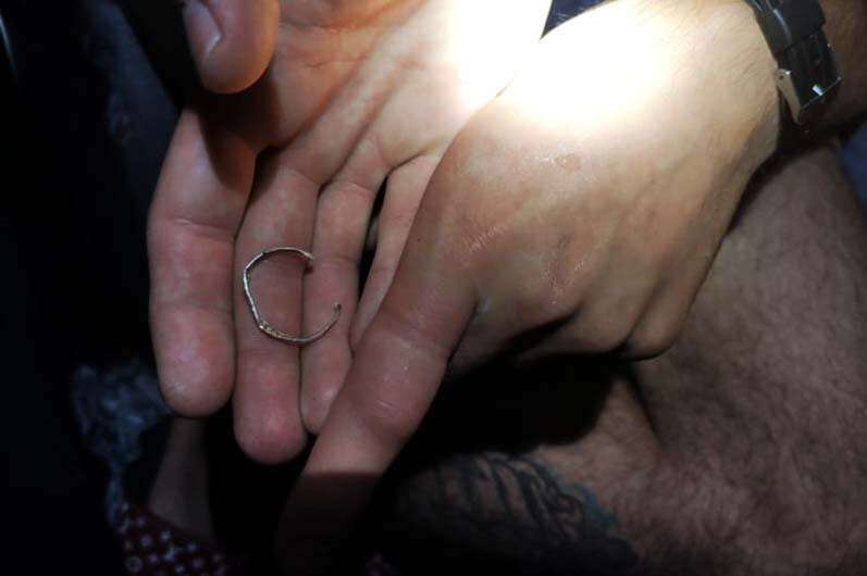 В Днепре кольцо застряло на пальце руки молодого парня, Новости Днепра