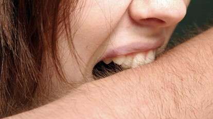 укусила и побила мужчину.jpg