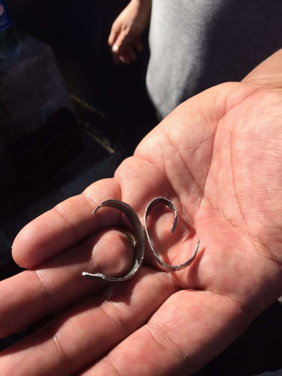 В Днепре трое спасателей снимали кольцо с пальца подростка