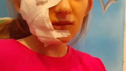  В Днепре в Краснополье собака укусила ребенка за лицо: известны новые подробности (фото)