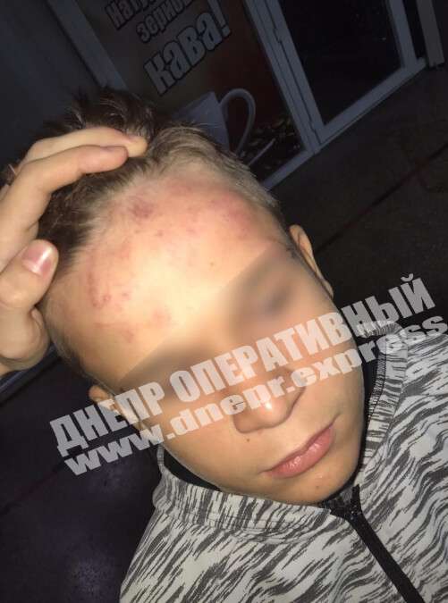 Под Днепром дети-цыгане избили мальчика: фото