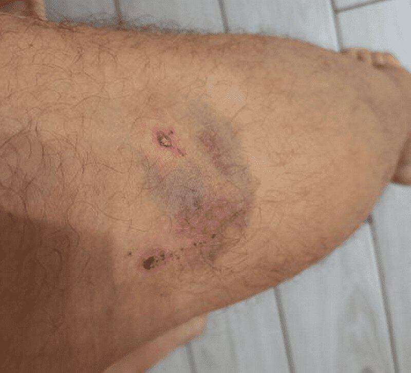 В Днепре к мужчине подбежала собака и укусила за ногу: подробности