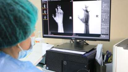 Новый рентгенаппарат 16 больница Днепр