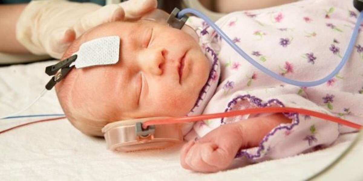 Скринінг слуху новонароджених