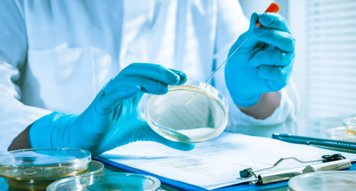 Подросток заболел листериозом