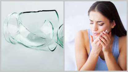 Днепрянка сломала зуб