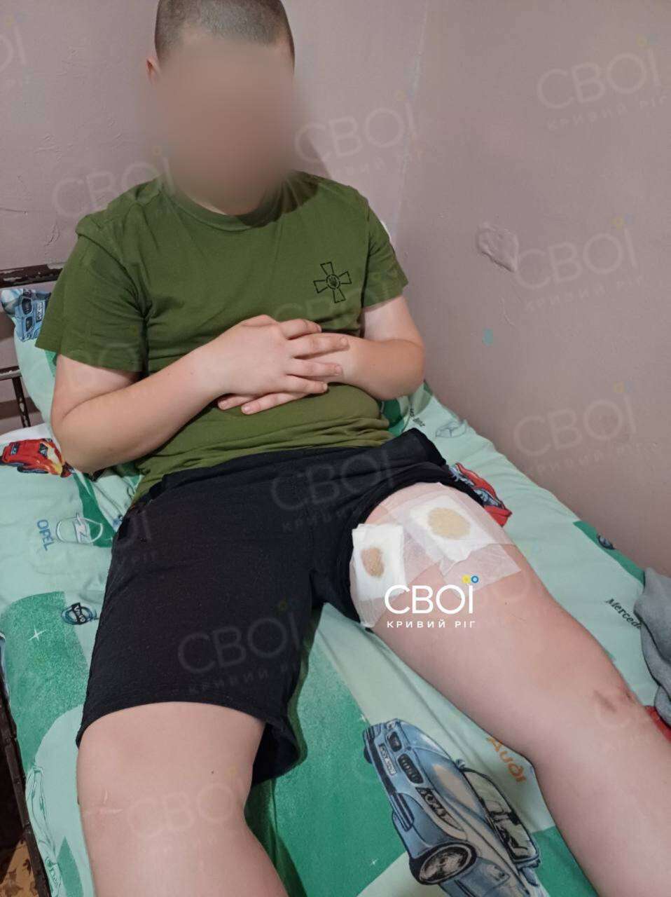 Стреляли в подростка