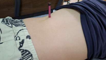 Олівець проштрикнув дитину