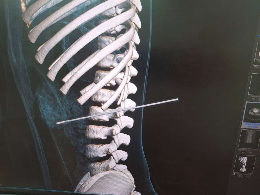 512586351_1061881185922270_814027215745052799_n