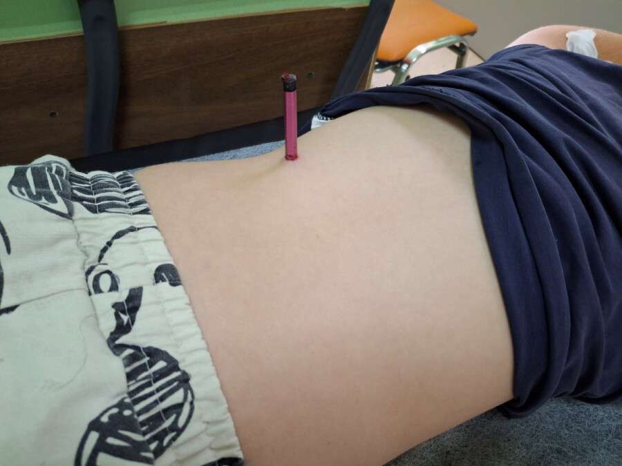 Карандаш проткнул ребенка