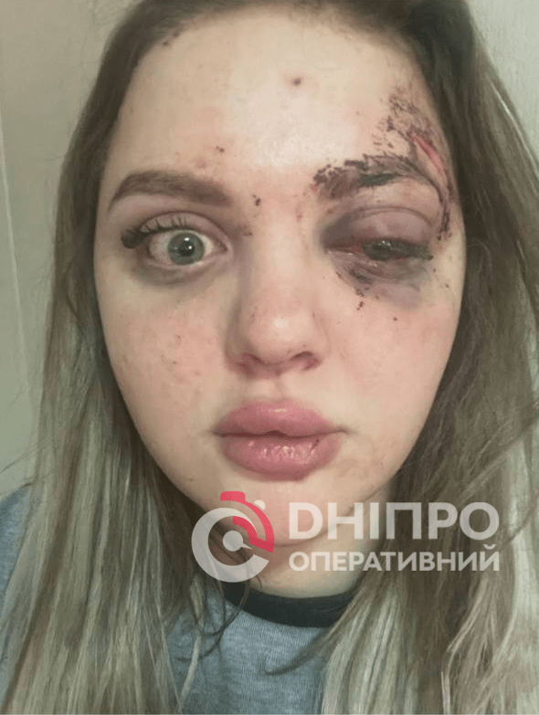 У Дніпрі прихильник рф регулярно уникає відповідальності