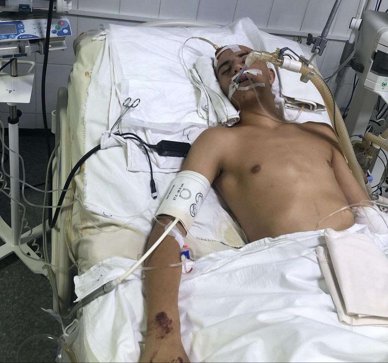 Постраждав хлопець в ДТП