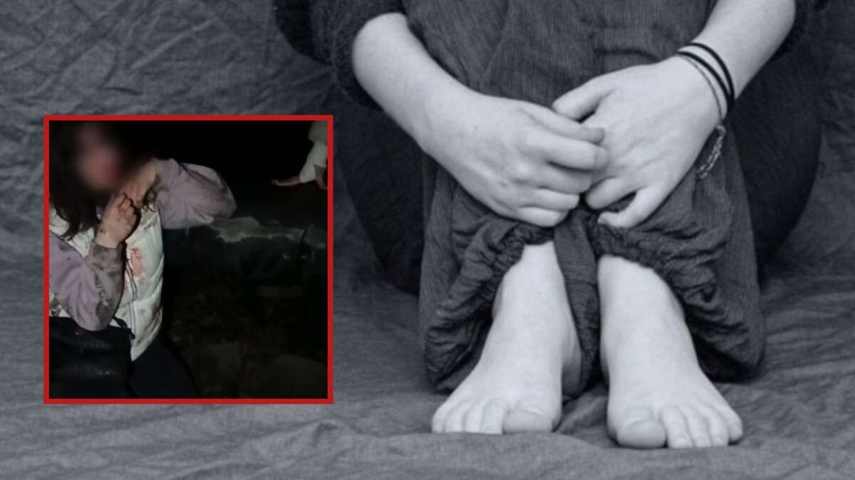 Побиття 15-річної дівчини на Дніпропетровщині - відкрито кримінальне провадження