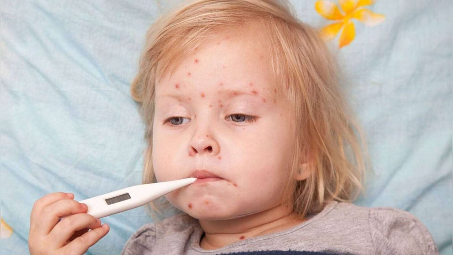 У Дніпрі зафіксували підозри на небезпечне заразне захворювання
Фахівці Дніпропетровського обласного центру контролю та профілактики хвороб провели чергову перевірку стосовно санітарно-епідемічної ситуації на Дніпропетровщині. В обласному центрі заф