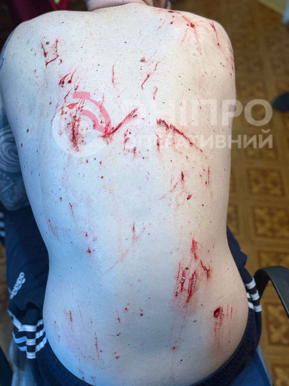 Конфликт соседей в Соборном районе: избиение и проникновение в квартиру