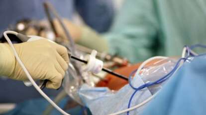 Військова хірургія для цивільних