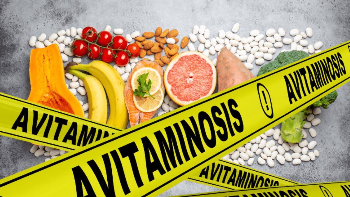 Авітаміноз взимку
