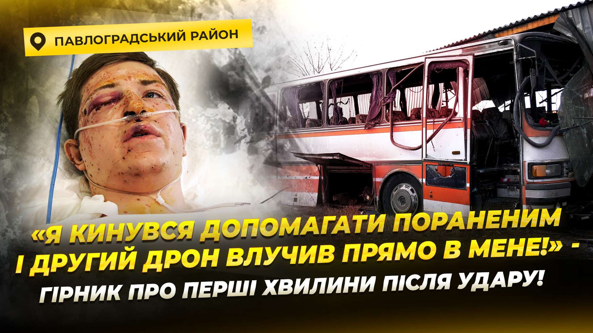 Потрапив під удар, рятуючи колег: у Дніпрі лікують поранених після обстрілу автобуса в Тернівці
Тернівка на Дніпропетровщині оговтується від одного з найкривавіших ударів росіян - 1 лютого ворожі дрони влучили по автобусу із працівниками…