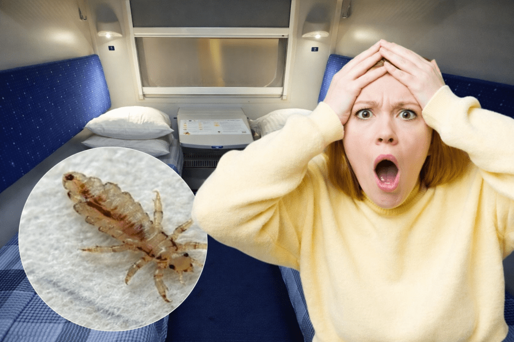 Вши в поезде: пассажирку из Днепра покусали в вагоне люкс