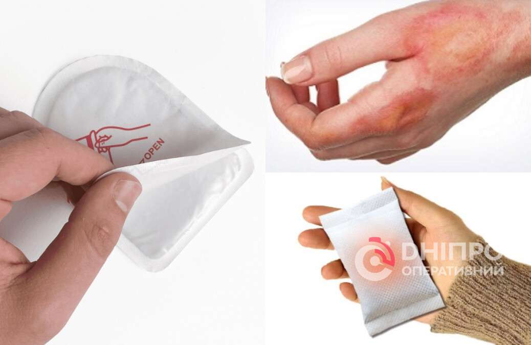 Хімічні грілки: як не отримати опіки