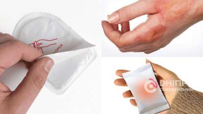 Хімічні грілки: як не отримати опіки