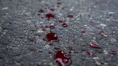 Юнак стріляв у чоловіка у Новокодацькому районі 9 липня: що відомо